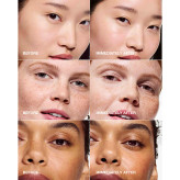 سرم ابرسان کلینیک برای انواع پوست