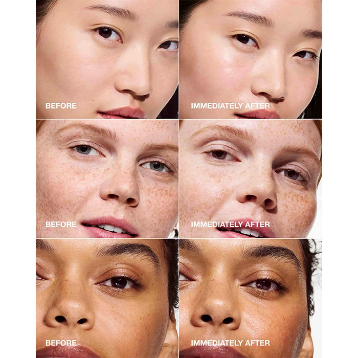 سرم ابرسان کلینیک برای انواع پوست