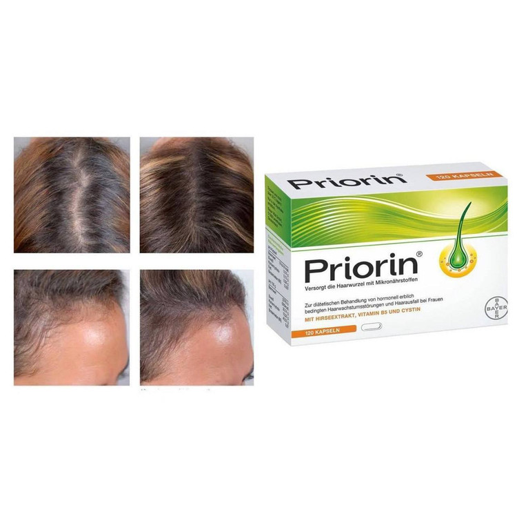 مکمل تقویت کننده مو پریورین