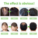 کپسول پریورین بایر